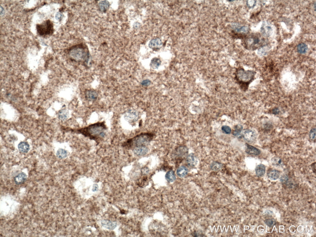 IHC staining of human brain using 66593-1-Ig