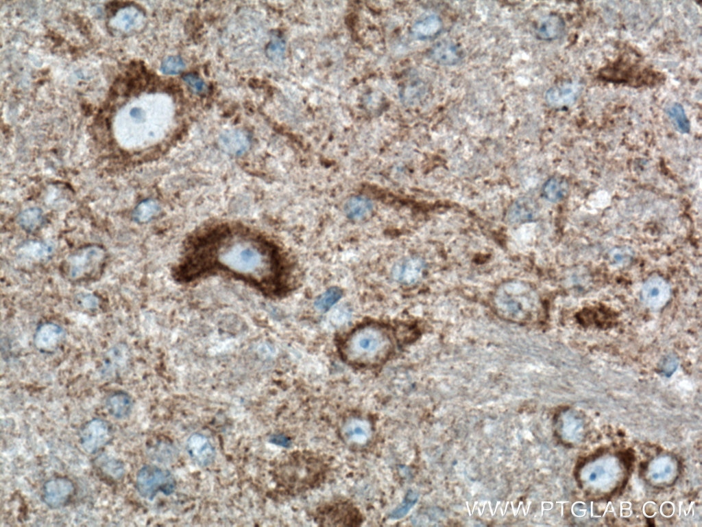 Immunohistochemistry (IHC) staining of mouse brain tissue using TOM70 Monoclonal antibody (66593-1-Ig)