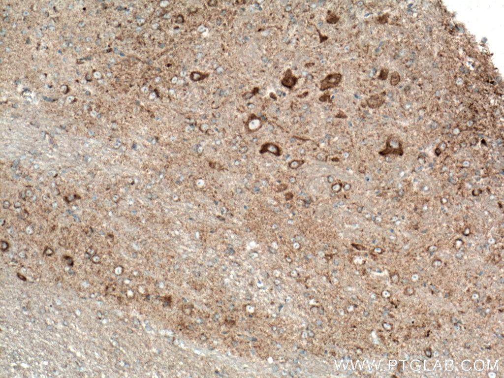 Immunohistochemistry (IHC) staining of mouse brain tissue using TOM70 Monoclonal antibody (66593-1-Ig)