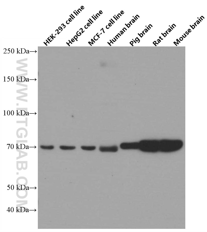 Western Blot (WB) analysis of various lysates using TOM70 Monoclonal antibody (66593-1-Ig)
