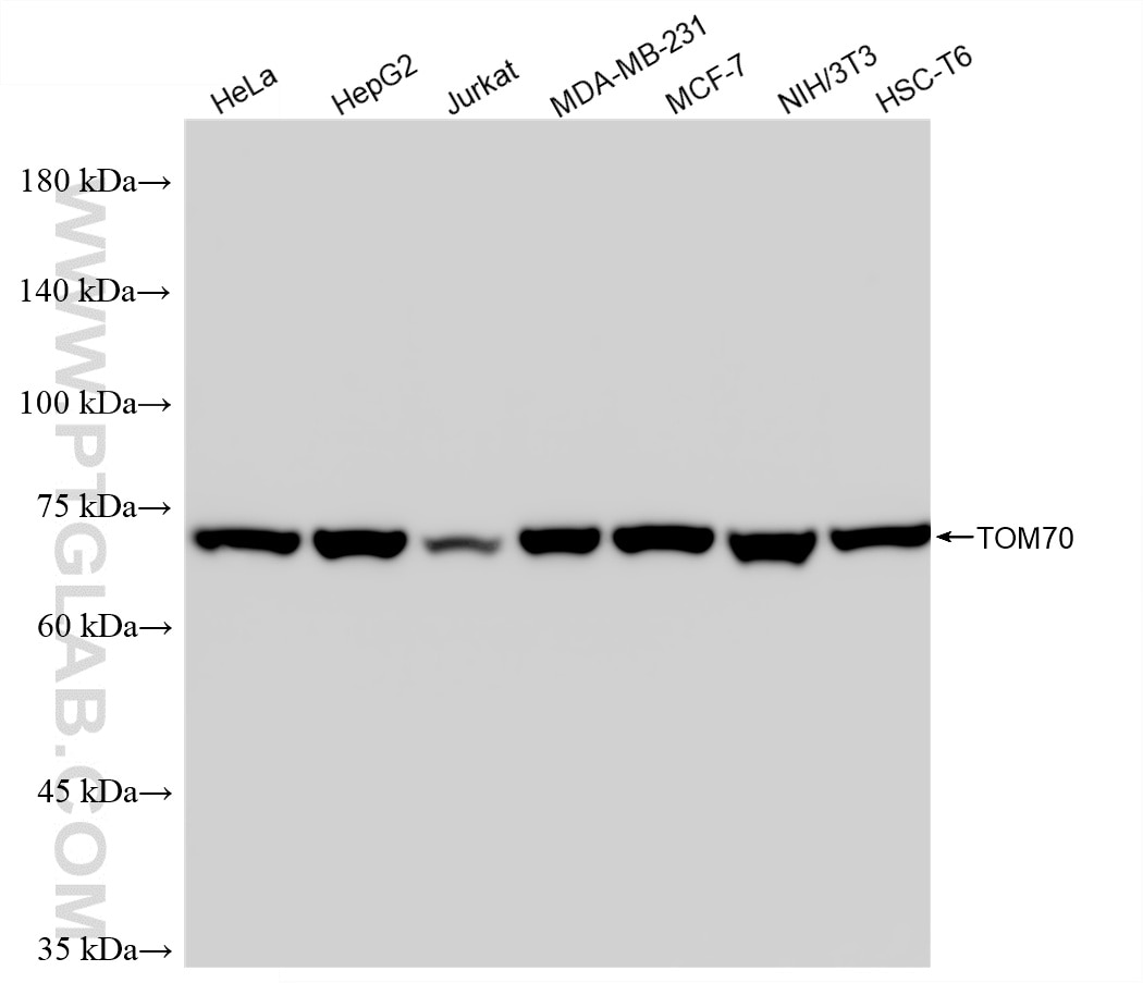 Western Blot (WB) analysis of various lysates using TOM70 Recombinant monoclonal antibody (86840-3-RR)