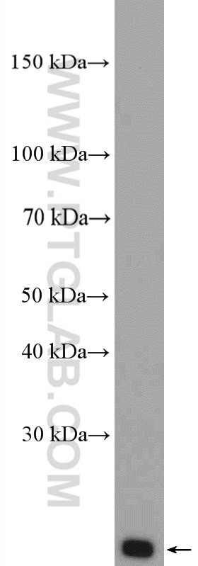 Western Blot (WB) analysis of HeLa cells using Tom22 Polyclonal antibody (11278-1-AP)