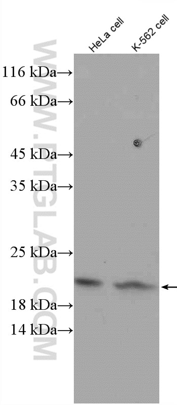 Western Blot (WB) analysis of HeLa cells using Tom22 Polyclonal antibody (11278-1-AP)