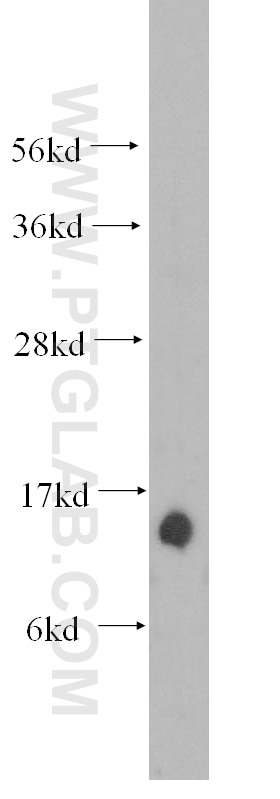 Tom22 Polyclonal antibody