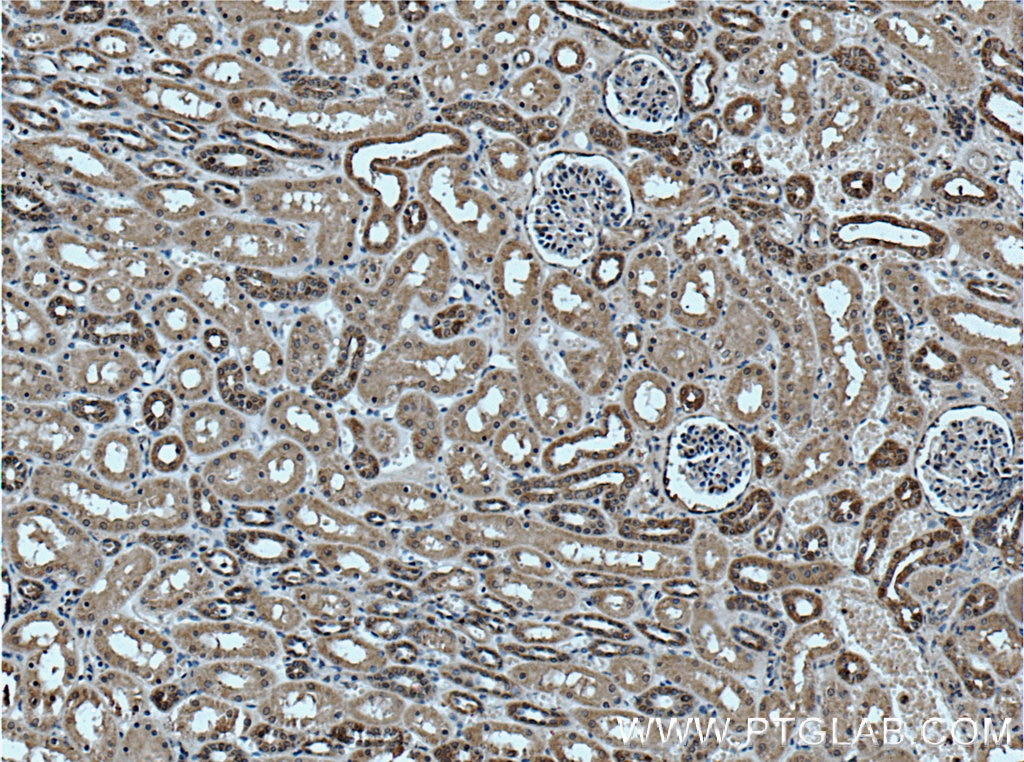 Immunohistochemistry (IHC) staining of human kidney tissue using Tom22 Monoclonal antibody (66562-1-Ig)