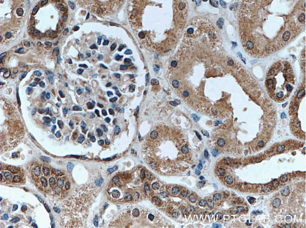 Immunohistochemistry (IHC) staining of human kidney tissue using Tom22 Monoclonal antibody (66562-1-Ig)