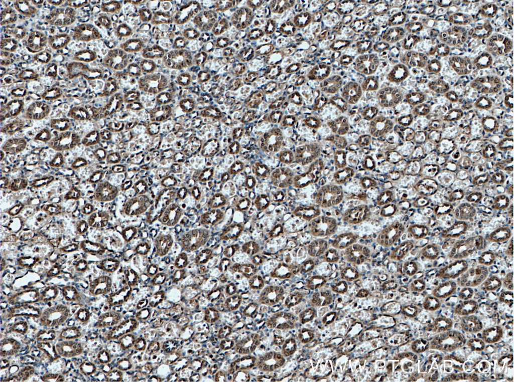 Immunohistochemistry (IHC) staining of human kidney tissue using Tom22 Monoclonal antibody (66562-1-Ig)