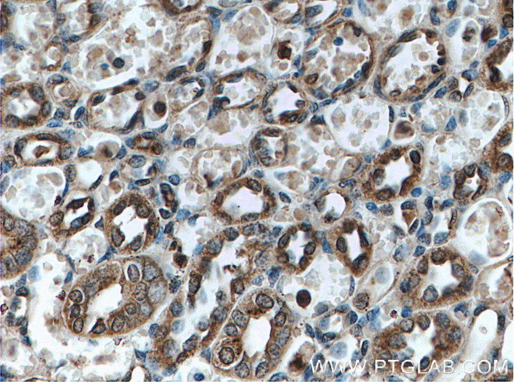 Immunohistochemistry (IHC) staining of human kidney tissue using Tom22 Monoclonal antibody (66562-1-Ig)