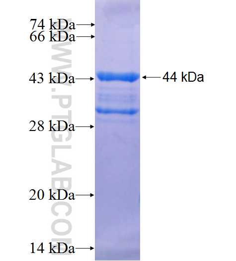 TOMM22 fusion protein Ag1797 SDS-PAGE
