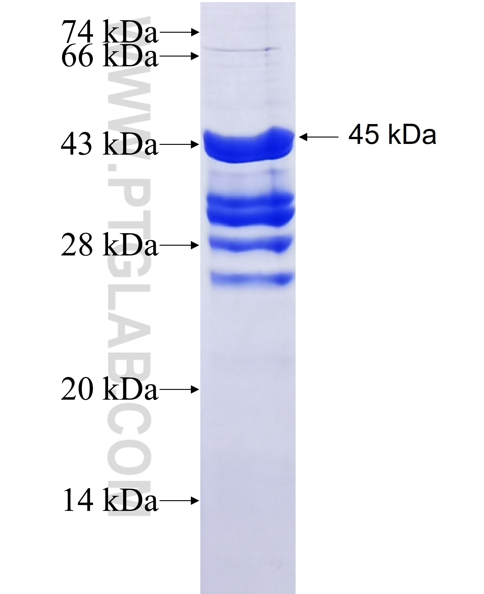 TOMM22 fusion protein Ag1797 SDS-PAGE