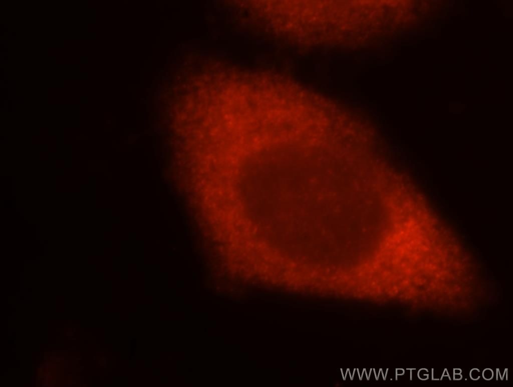 Immunofluorescence (IF) / fluorescent staining of MCF-7 cells using TOMM34 Polyclonal antibody (12196-1-AP)