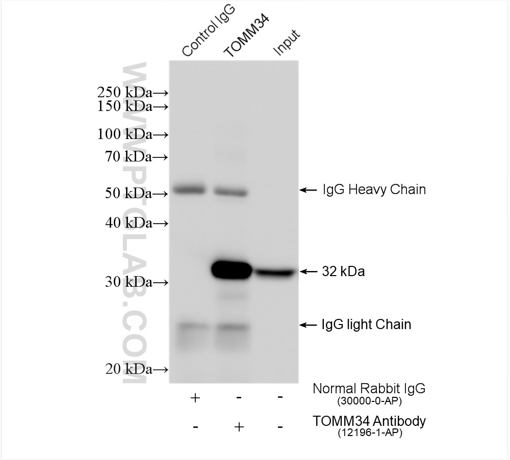 Immunoprecipitation (IP) experiment of HeLa cells using TOMM34 Polyclonal antibody (12196-1-AP)