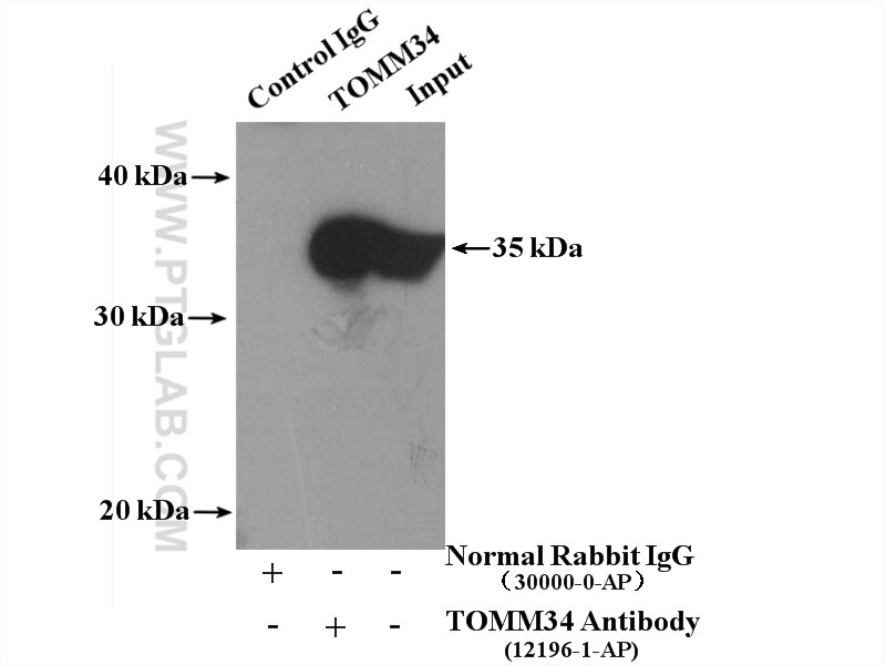 Immunoprecipitation (IP) experiment of HeLa cells using TOMM34 Polyclonal antibody (12196-1-AP)