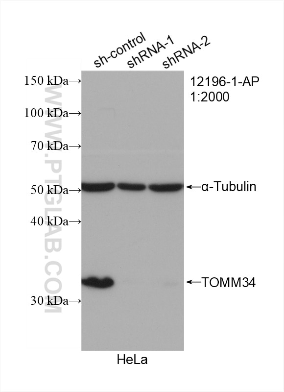 Western Blot (WB) analysis of HeLa cells using TOMM34 Polyclonal antibody (12196-1-AP)