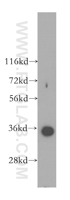 TOMM34 Polyclonal antibody
