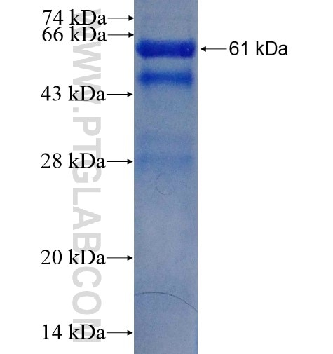 TOMM34 fusion protein Ag2834 SDS-PAGE