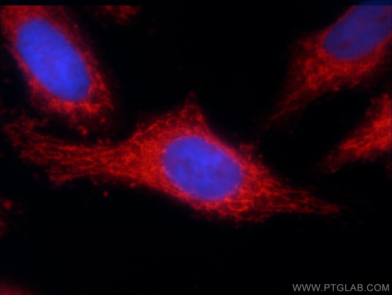 TOMM40 Polyclonal antibody