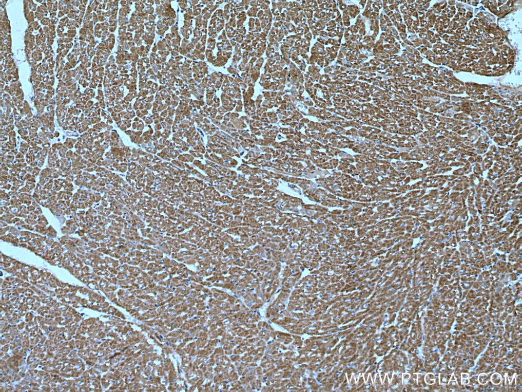 Immunohistochemistry (IHC) staining of human heart tissue using TOMM40 Polyclonal antibody (18409-1-AP)