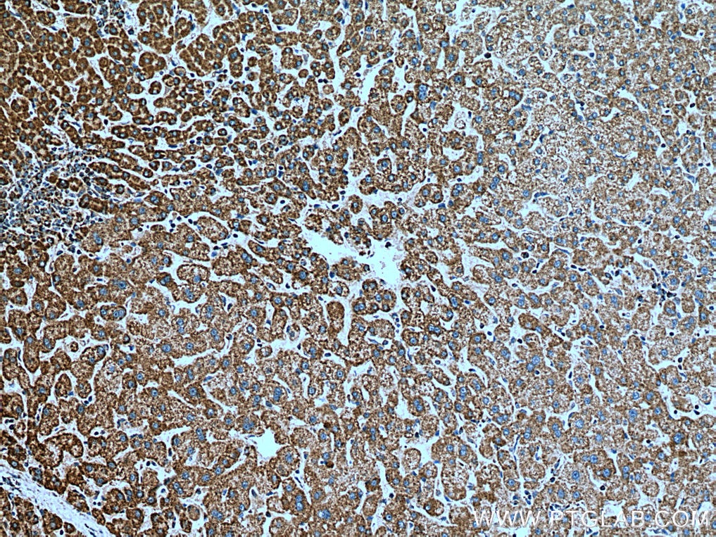 Immunohistochemistry (IHC) staining of human liver tissue using TOMM40 Polyclonal antibody (18409-1-AP)