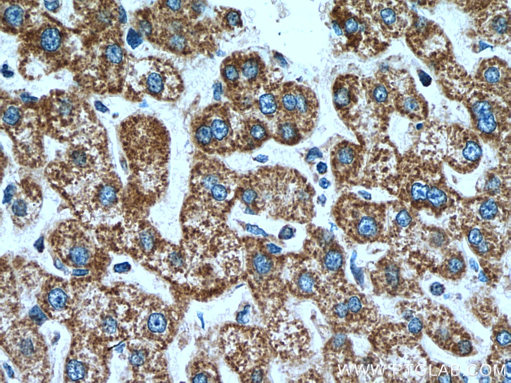 Immunohistochemistry (IHC) staining of human liver tissue using TOMM40 Polyclonal antibody (18409-1-AP)