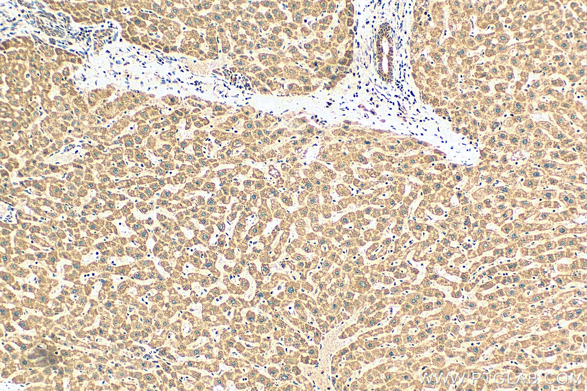 Immunohistochemistry (IHC) staining of human liver tissue using TOMM40 Polyclonal antibody (18409-1-AP)