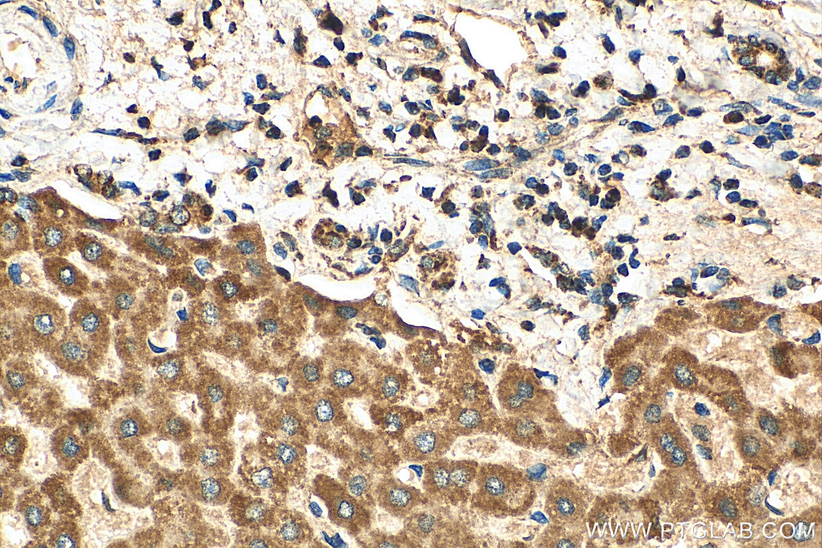 Immunohistochemistry (IHC) staining of human liver tissue using TOMM40 Polyclonal antibody (18409-1-AP)