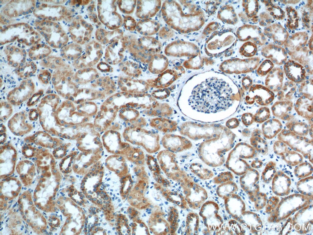 Immunohistochemistry (IHC) staining of human kidney tissue using TOMM40 Polyclonal antibody (18409-1-AP)