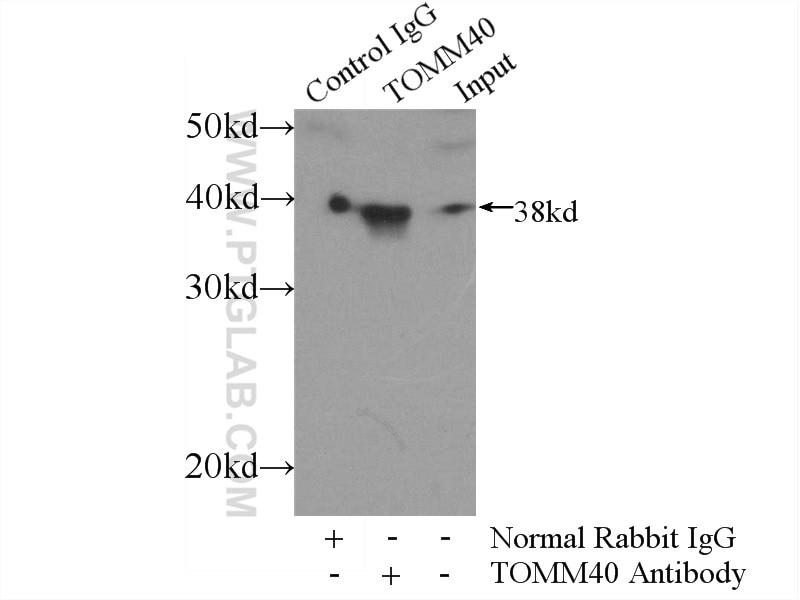 Immunoprecipitation (IP) experiment of mouse liver tissue using TOMM40 Polyclonal antibody (18409-1-AP)
