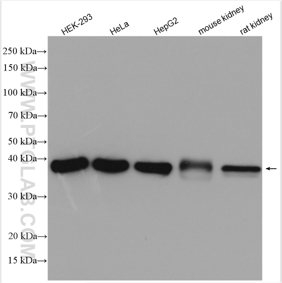 Western Blot (WB) analysis of various lysates using TOMM40 Polyclonal antibody (18409-1-AP)
