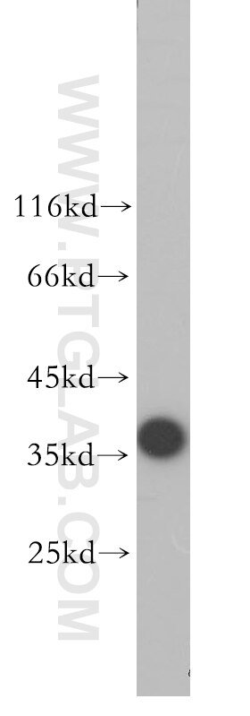 Western Blot (WB) analysis of human brain tissue using TOMM40 Polyclonal antibody (18409-1-AP)