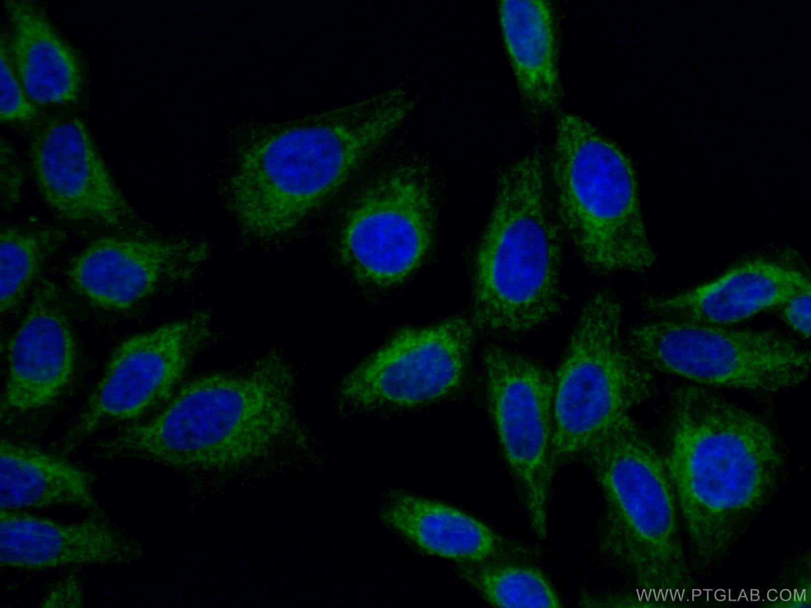 IF Staining of HepG2 using 66658-1-Ig