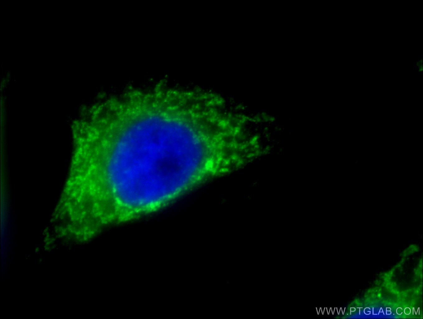 IF Staining of HepG2 using 66658-1-Ig