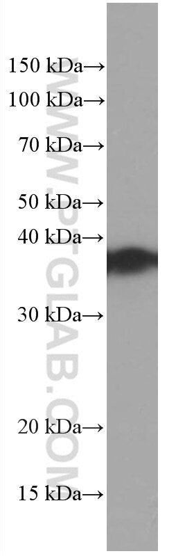 Western Blot (WB) analysis of human brain tissue using TOMM40 Monoclonal antibody (66658-1-Ig)