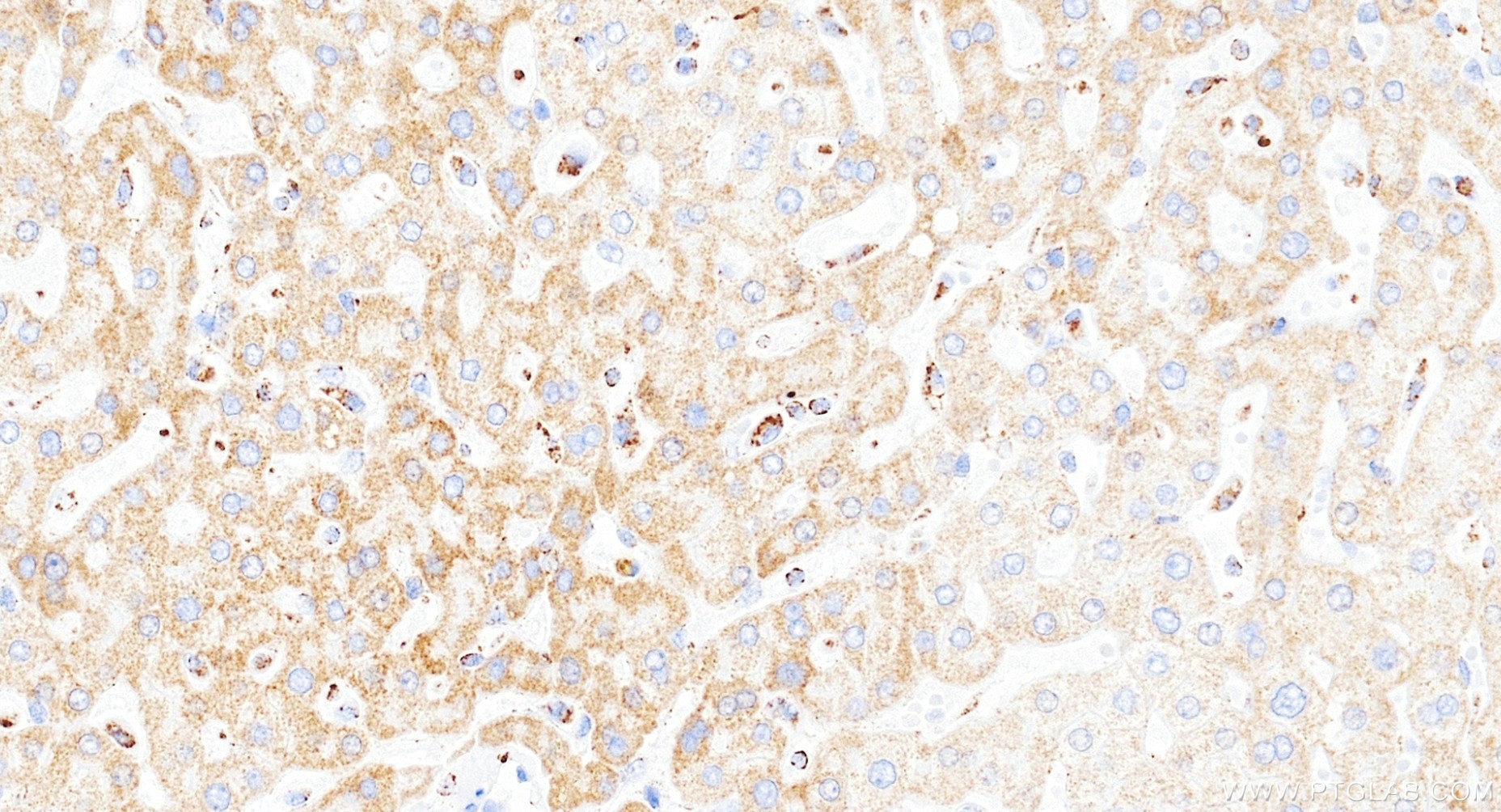 Immunohistochemistry (IHC) staining of human liver tissue using TOMM40 Recombinant monoclonal antibody (85773-4-RR)