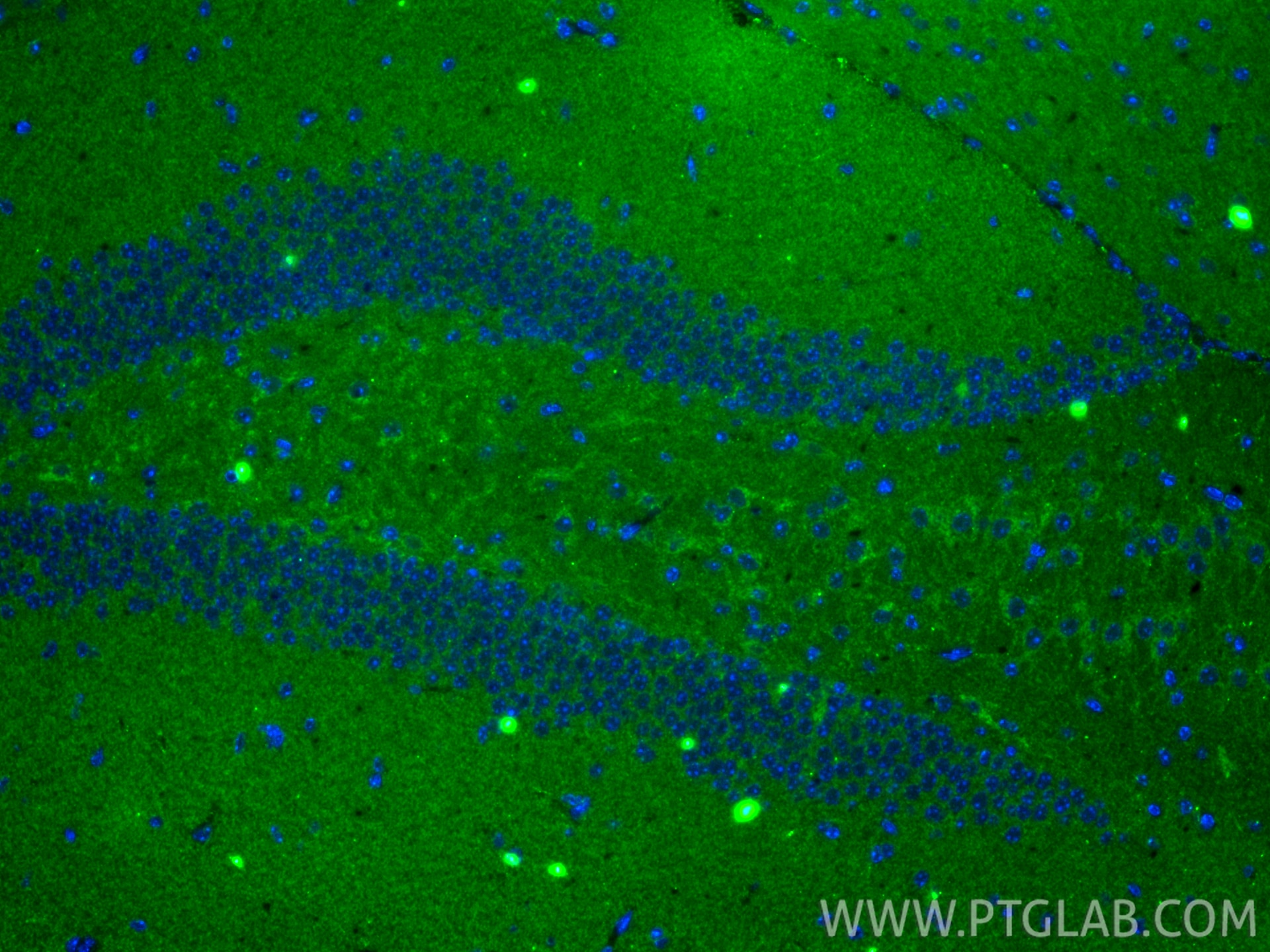 Immunofluorescence (IF) / fluorescent staining of mouse brain tissue using TOMM40L Recombinant monoclonal antibody (86943-1-RR)
