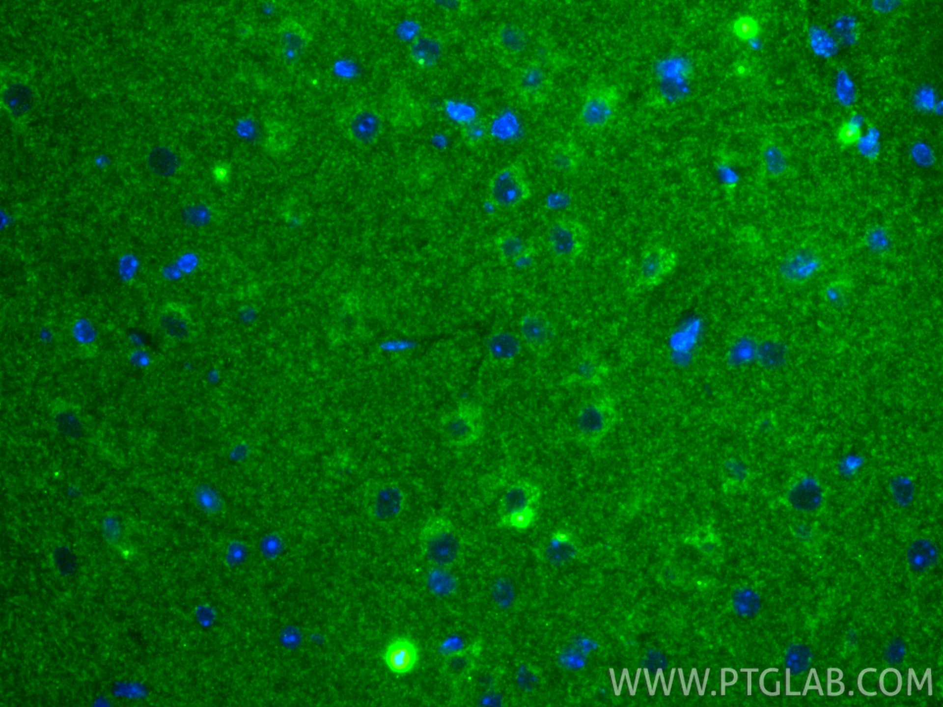 Immunofluorescence (IF) / fluorescent staining of mouse brain tissue using TOMM40L Recombinant monoclonal antibody (86943-1-RR)