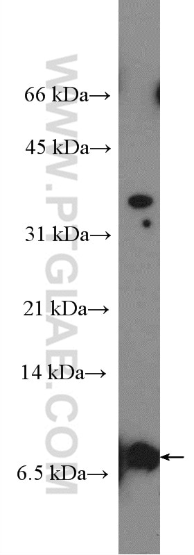 Western Blot (WB) analysis of mouse testis tissue using TOMM5 Polyclonal antibody (25607-1-AP)
