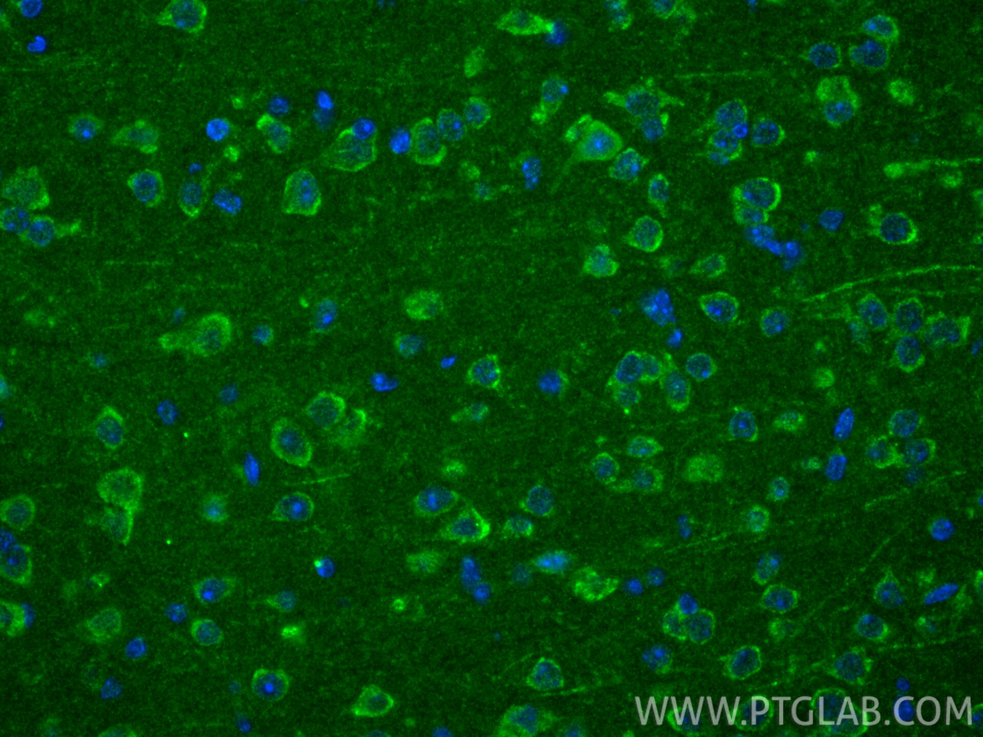 IF Staining of mouse brain using 16689-1-AP Immunofluorescence (IF) / fluorescent staining of mouse brain tissue using TOMM6 Polyclonal antibody (16689-1-AP)