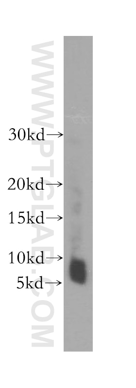 Western Blot (WB) analysis of human skeletal muscle tissue using TOMM6 Polyclonal antibody (16689-1-AP)