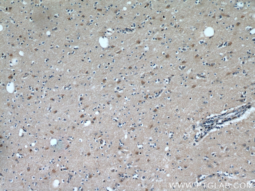 Immunohistochemistry (IHC) staining of human brain tissue using TOMM7 Polyclonal antibody (15071-1-AP)