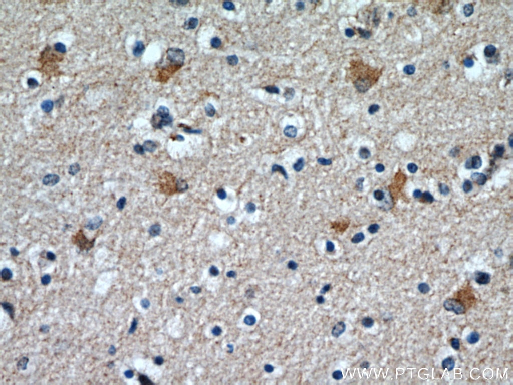 Immunohistochemistry (IHC) staining of human brain tissue using TOMM7 Polyclonal antibody (15071-1-AP)