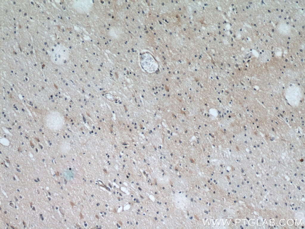 Immunohistochemistry (IHC) staining of human brain tissue using TOMM7 Polyclonal antibody (15071-1-AP)