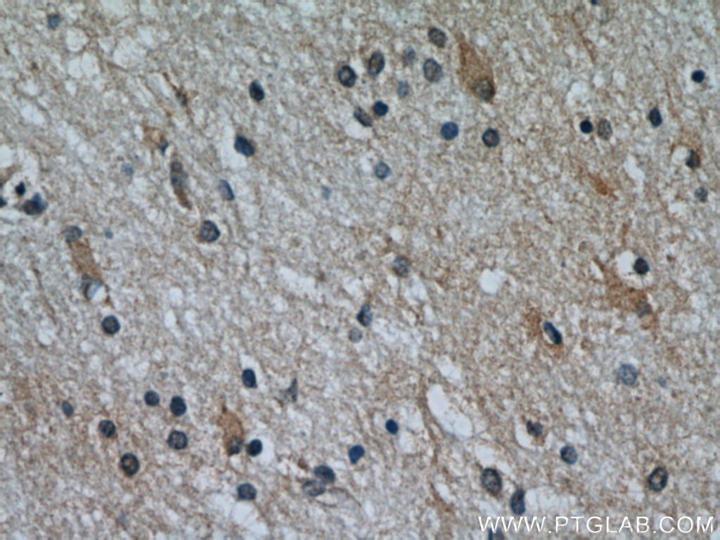 IHC staining of human brain using 15071-1-AP