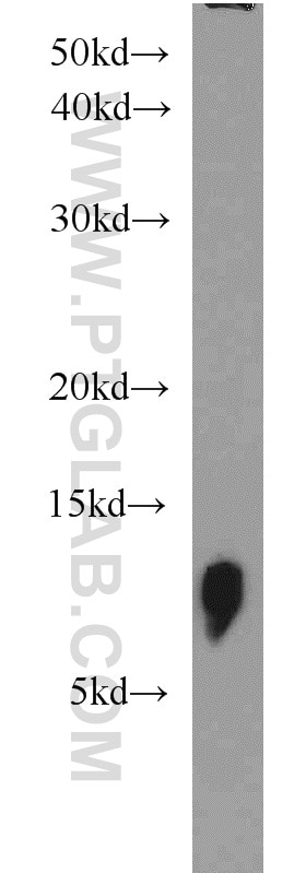 TOMM7 Polyclonal antibody