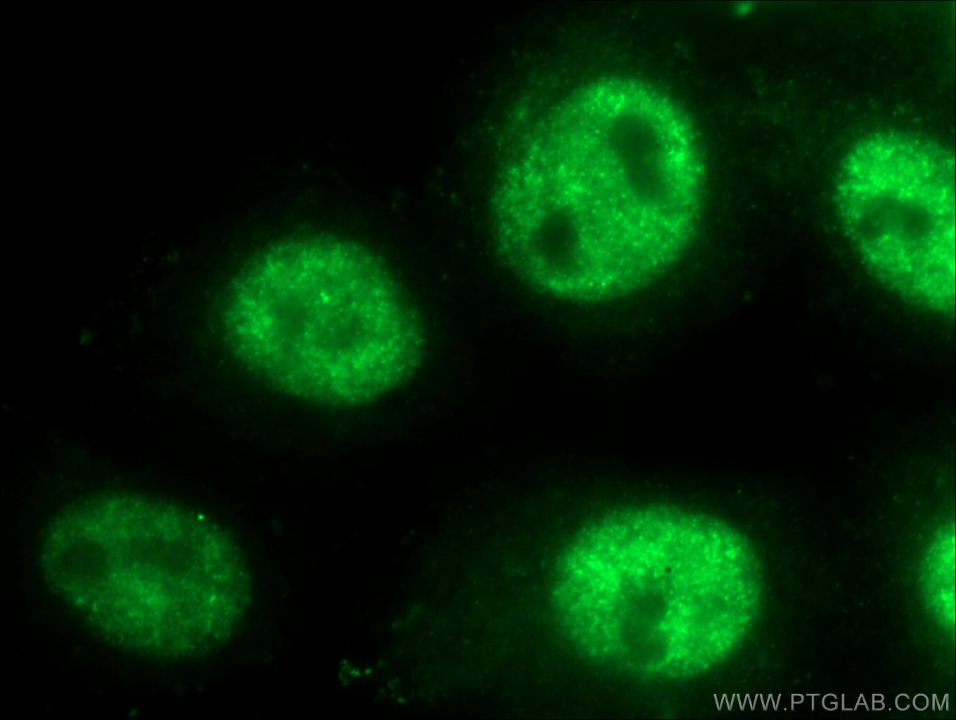 Immunofluorescence (IF) / fluorescent staining of HepG2 cells using TOP1 Polyclonal antibody (20705-1-AP)