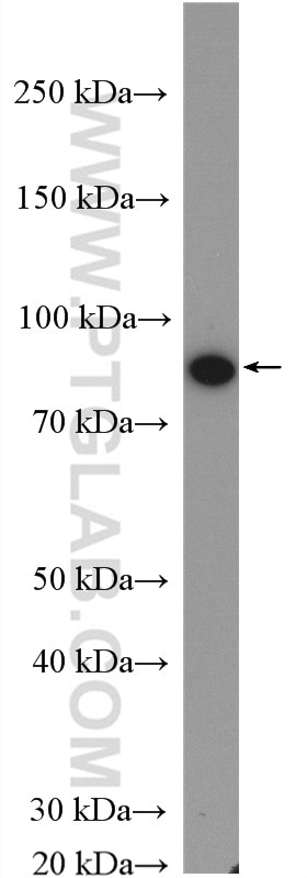 Western Blot (WB) analysis of L02 cells using TOP1 Polyclonal antibody (20705-1-AP)