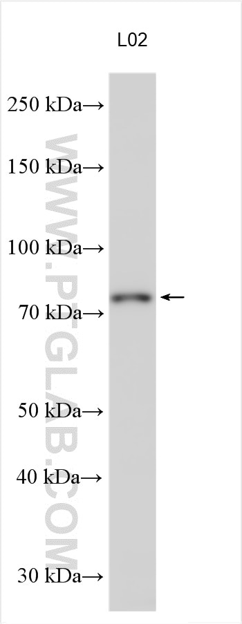 Western Blot (WB) analysis of various lysates using TOP1 Polyclonal antibody (20705-1-AP)
