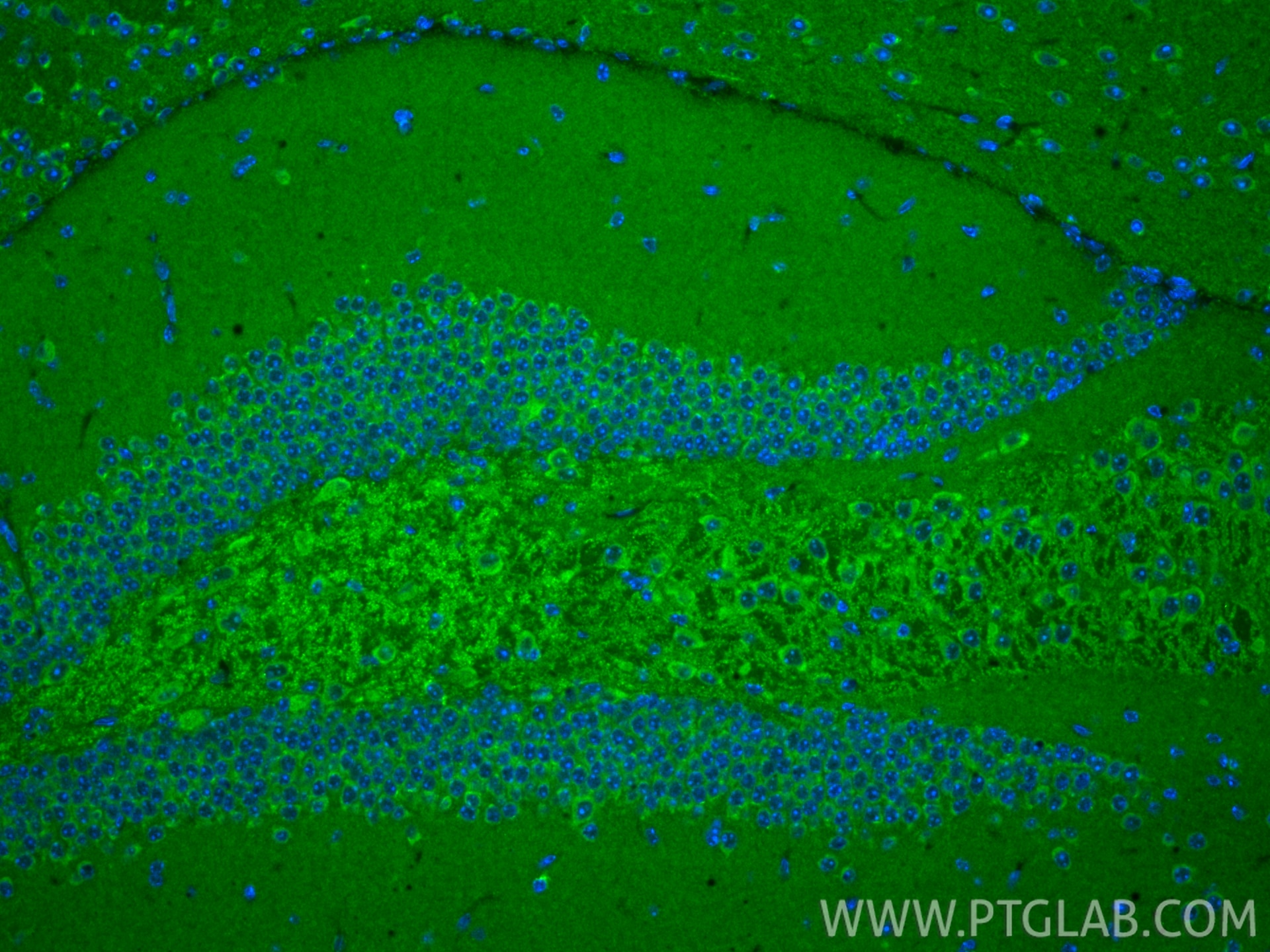 Immunofluorescence (IF) / fluorescent staining of mouse brain tissue using TOP1MT Polyclonal antibody (16540-1-AP)