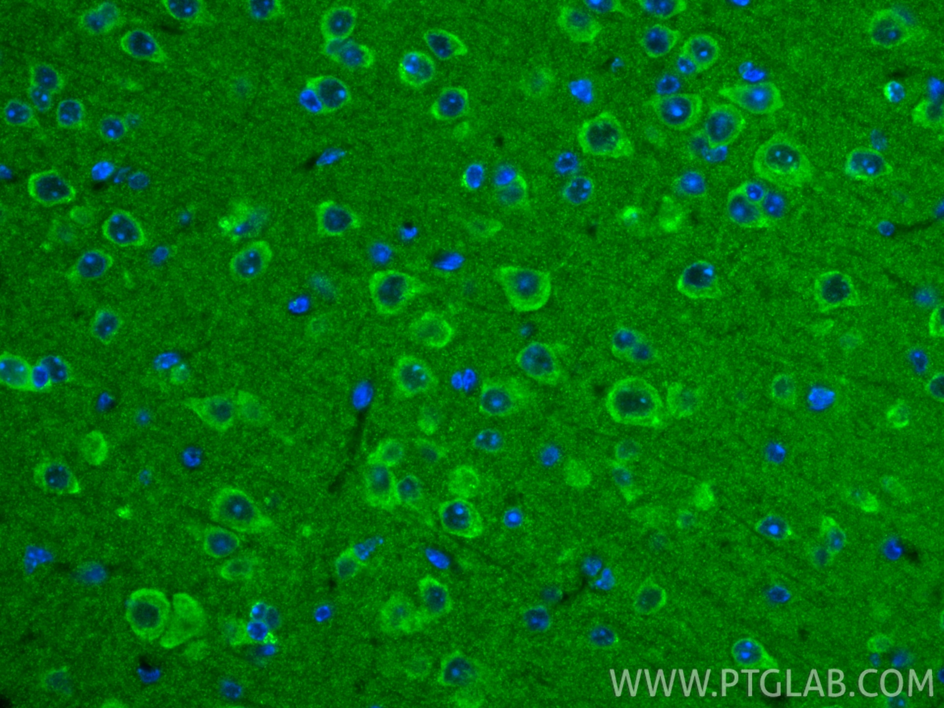 Immunofluorescence (IF) / fluorescent staining of mouse brain tissue using TOP1MT Polyclonal antibody (16540-1-AP)