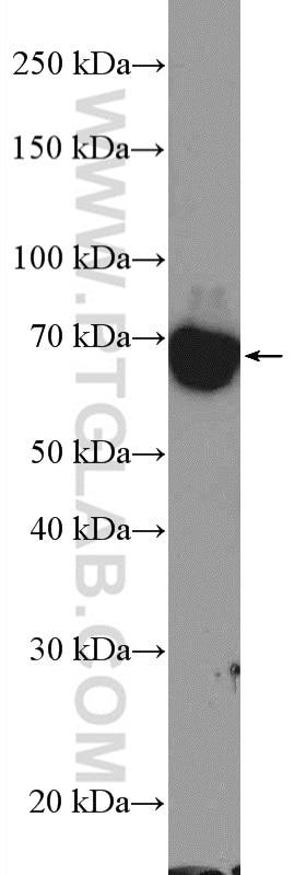 Western Blot (WB) analysis of COLO 320 cells using TOP1MT Polyclonal antibody (16540-1-AP)